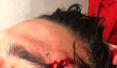 Juan Pablo Vigón sufrió una herida de consideración