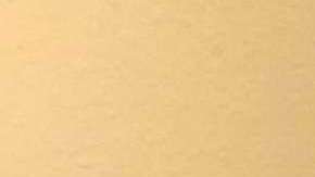 Víctor Espinoza se recupera de fractura de cuello en su casa de Del Mar, California.