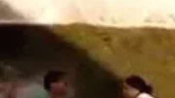 El hombre terminó con quemaduras en varias partes de su cuerpo.