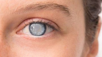 El glaucoma es la primera causa de ceguera en EEUU.