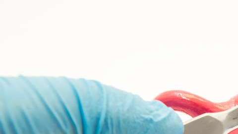 Un implante tópico terminó en histerectomía.