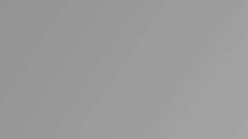 El tratamiento depende del cuan grave tenga la curvatura.