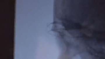 Fue un milagro que el pincho no atravesara ningún vaso sanguíneo importante ni los ojos o cerebro del niño.