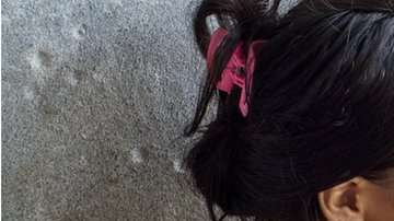 Más de 39 millones de personas están subalimentadas en la región.