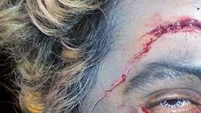 La sangre corre en Halloween