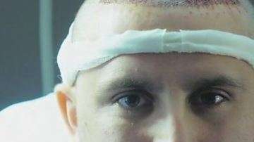 Se estima que más de 60,000 hombres viajan al año a la capital turca a realizarse este tratamiento.