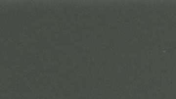 Su sorpresiva cirugía de riñón tendría otra explicación