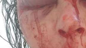 El rostro de Higginson quedó irreconocible.