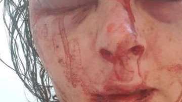 El rostro de Higginson quedó irreconocible.