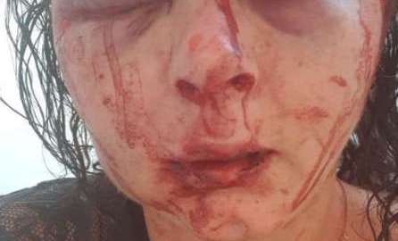 El rostro de Higginson quedó irreconocible.