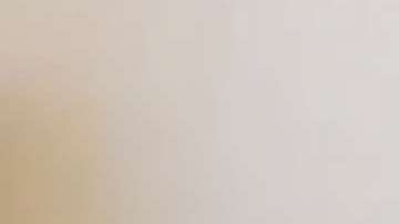 Un niño británico tiene una rara alergia al sol