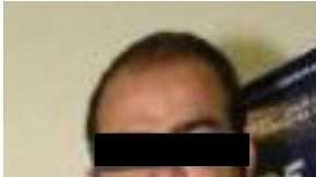 'El Betito' se hizo prótesis capilar y bypass gástrico para bajar 30 kilos y no ser identificado.