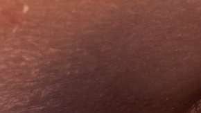 Los ojos amarillentos y viscosos indican que algo no anda bien.