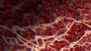 Una célula cancerosa es atacada por un tratamiento.