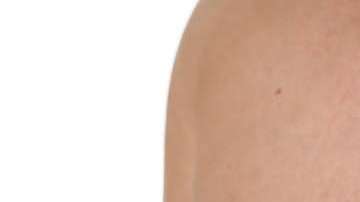 Los hombres tienen muy pocas probabilidades de desarrollar cáncer de mama.