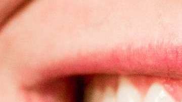 teeth-1652976_960_720