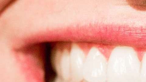 teeth-1652976_960_720