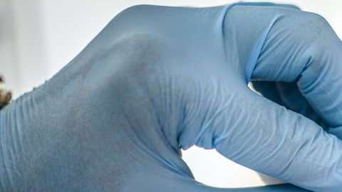 La meningitis puede tener consecuencias graves si no se trata a tiempo.