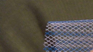 Cientos de mujeres sufrieron un dolor insoportable por culpa de estas mallas.