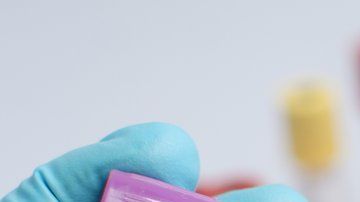 Los trasplantes de células madre como una posible vía para eliminar el VIH del organismo.