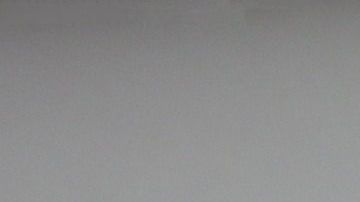 Por fortuna, los clavos no le causaron heridas de gravedad.