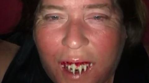 Por un error estuvo a punto de perder los dientes.