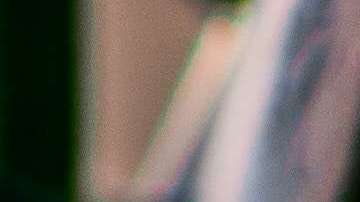 Las personas sin hogar viven en pobres condiciones de higiene.