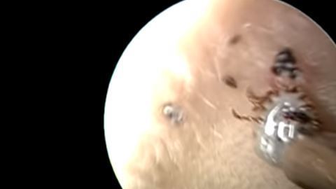 La garrapata se aferraba a la piel.