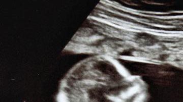 El niño nació sano en junio