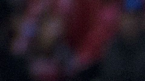 Maradona sufre de artrosis en las rodillas, enfermedad que le impide caminar con facilidad