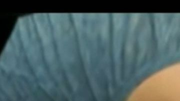 El brazo atascado. Captura