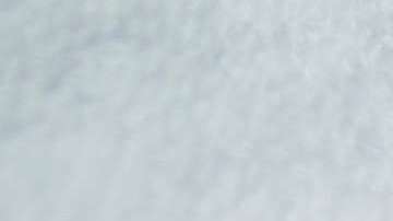 Se desconocen las causas exactas de esta enfermedad.