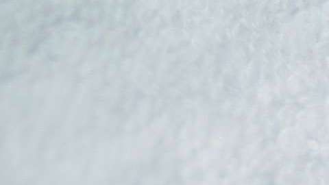 Se desconocen las causas exactas de esta enfermedad.