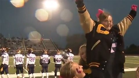 t0k69-cheerleader-down-syndrome-1