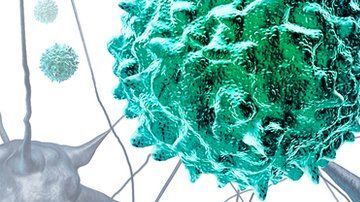 La mielitis flácida aguda surge repentinamente.