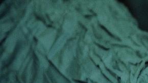 Los errores durante una cirugía no suelen ser comunes.