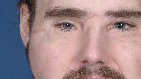 Cameron Underwood con el rostro reconstruido