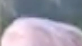 Un niño reconoce la anomalía congénita que padece en otra chica y se acerca a ella.