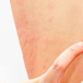 shutterstock_421337101