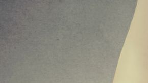 La mujer asegura que debe someterse a una cirugía reconstructiva.