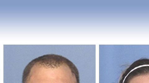 Los Wagner. Suministrada