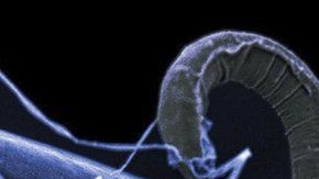 Un nemátodo o gusano cilíndrico sobre una película de otros organismos.