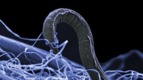 Un nemátodo o gusano cilíndrico sobre una película de otros organismos.