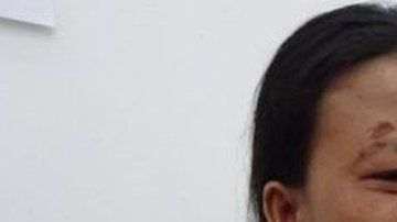 Emilia sobrevivió, pero perdió a su hija y sufrió severas heridas.