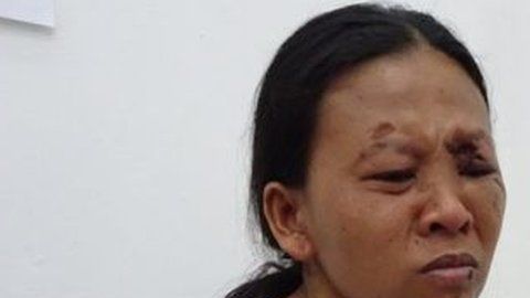 Emilia sobrevivió, pero perdió a su hija y sufrió severas heridas.