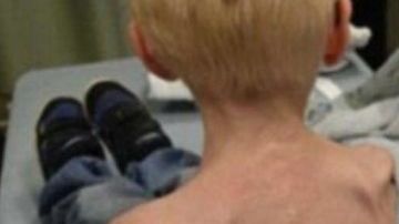 Actualmente, el menor tiene nueve años.