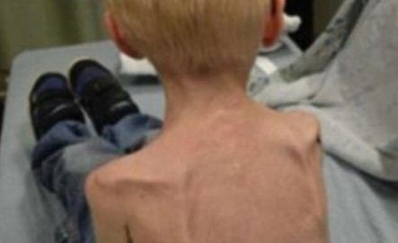 Actualmente, el menor tiene nueve años.