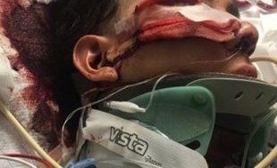 Luis López de 18 años quedó inconsciente tras un golpe en la cabeza