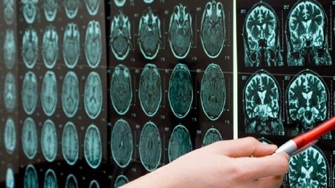 La revolucionaria técnica, denominada Clarity, consiste en un proceso químico  que pone transparente al cerebro sin alterar su forma ni conexiones.