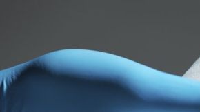 El Linfoma Anaplásico de Células Grandes asociado a implantes de mama es un tipo de cáncer raro.